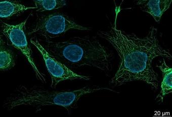 研究人员将神经网络与各种显微镜技术相结合 以改善科学家窥视细胞的方式